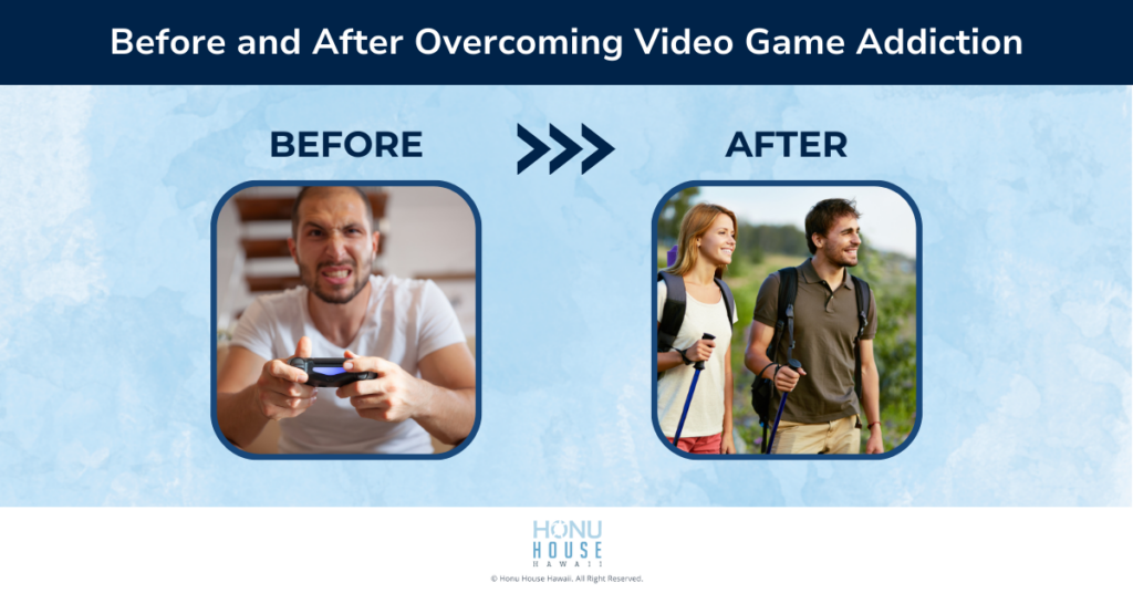 Before and After Overcoming Video Game Addiction