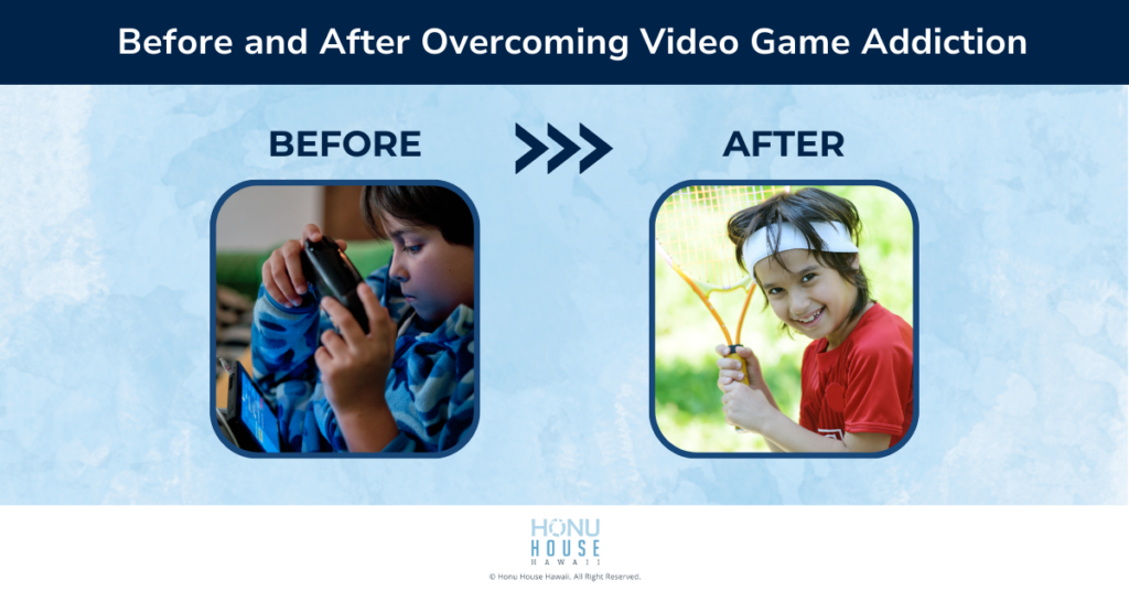 Before and After Overcoming Video Game Addiction